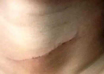 പതിനൊന്നുകാരന് അയല്‍വാസിയുടെ കുത്തേറ്റു