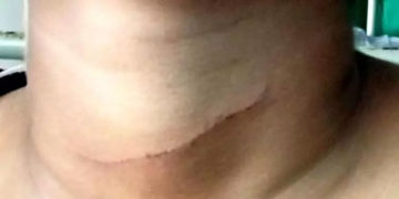 പതിനൊന്നുകാരന് അയല്‍വാസിയുടെ കുത്തേറ്റു