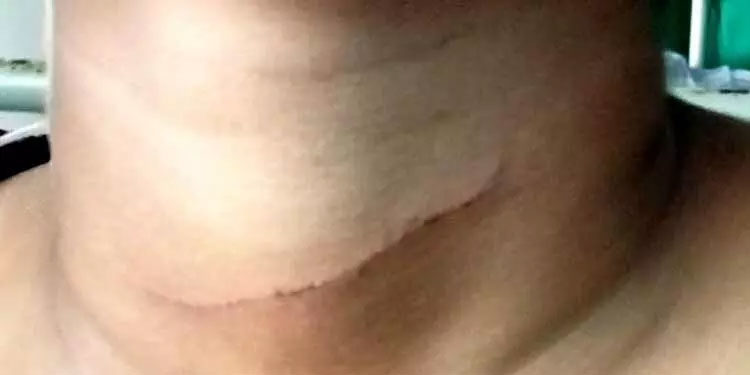 പതിനൊന്നുകാരന് അയല്വാസിയുടെ കുത്തേറ്റു