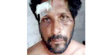 തുറിച്ചുനോക്കിയെന്നാരോപിച്ച് യുവാവിനും ഭാര്യക്കും മർദനം