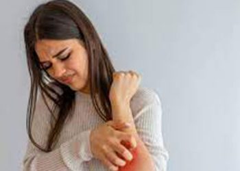 അറിയാം സോറിയാസിസിന്റെ ആയുർവേദ പരിഹാരം