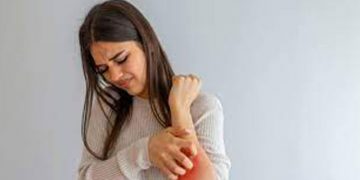 അറിയാം സോറിയാസിസിന്റെ ആയുർവേദ പരിഹാരം