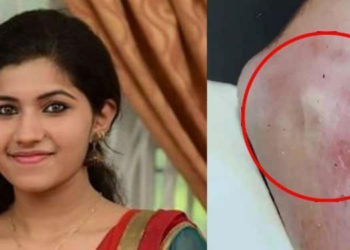 ചുണ്ടിൽ മുറിപ്പാട് , നഖം അമർത്തിയ പാടുകൾ ;  മിഷേലിന്‍റേത് കൊലപാതകം – ബന്ധുക്കൾ