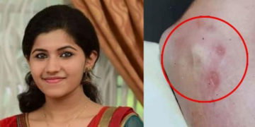 ചുണ്ടിൽ മുറിപ്പാട് , നഖം അമർത്തിയ പാടുകൾ ;  മിഷേലിന്‍റേത് കൊലപാതകം – ബന്ധുക്കൾ