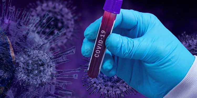 യുഎഇയില്‍ 2511 പേര്‍ക്ക് കൂടി കൊവിഡ് സ്ഥിരീകരിച്ചു ;  ഇന്ന് മൂന്ന് മരണം