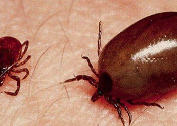 കോഴിക്കോട് ജില്ലയിൽ വീണ്ടും ചെള്ളുപനി