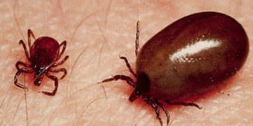 കോഴിക്കോട് ജില്ലയിൽ വീണ്ടും ചെള്ളുപനി