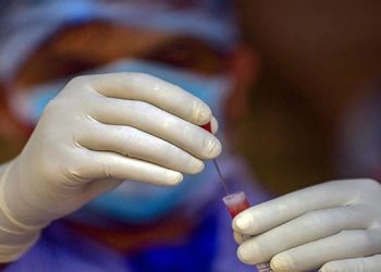 നേരിയ കോവിഡ് ; ഡിസ്ചാര്‍ജിന് ആന്റിജന്‍ പരിശോധന വേണ്ട