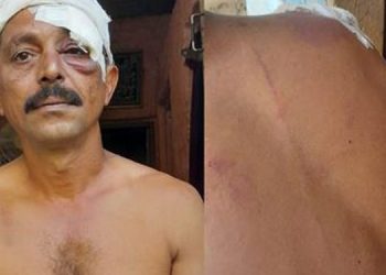 നെയ്യാറ്റിൻകരയിൽ വീണ്ടും ഗുണ്ടാ ആക്രമണം ; പിന്നിൽ ഡാൻസർ വിഷ്ണുവെന്ന് സൂചന