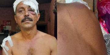 നെയ്യാറ്റിൻകരയിൽ വീണ്ടും ഗുണ്ടാ ആക്രമണം ; പിന്നിൽ ഡാൻസർ വിഷ്ണുവെന്ന് സൂചന