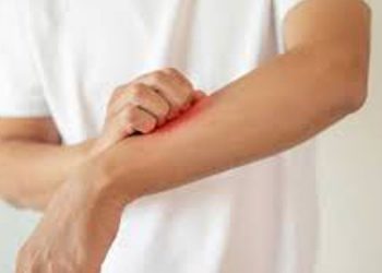 ഒമിക്രോണ്‍ ; തൊലിപ്പുറത്ത് പ്രത്യക്ഷമാകുന്ന ലക്ഷണം ഇത്