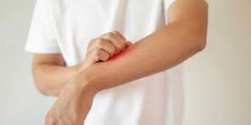 ഒമിക്രോണ്‍ ; തൊലിപ്പുറത്ത് പ്രത്യക്ഷമാകുന്ന ലക്ഷണം ഇത്