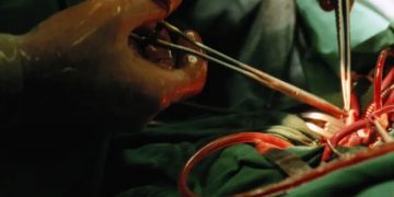 ലോഡ്ജിൽ വെച്ച് യൂ ട്യൂബിൽ നോക്കി ലിംഗമാറ്റ ശസ്ത്രക്രിയ ;  യുവാവിന് ദാരുണാന്ത്യം