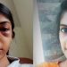 ഭർതൃമാതാവിന്റെ സുഹൃത്തിന്റെ ക്രൂരമർദനം ; മുഖത്ത് ഇടിയേറ്റ യുവതി ഗുരുതരാവസ്ഥയിൽ