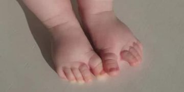 യുഎഇയില്‍ കിണറ്റില്‍ വീണ് മൂന്ന് വയസ്സുകാരന് ദാരുണാന്ത്യം