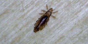 പേൻ ഇത്രയും അപകടകാരിയോ ? നിങ്ങൾ ഇതുവരെയും അറിയാത്ത ഒരു കാര്യം