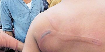 റേഷൻ ധാന്യം കൊണ്ടുപോകുന്നതിൽ തർക്കം ;  ലാത്തിച്ചാർജിൽ നാലു പേർക്കു പരുക്ക്