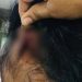 സ്ത്രീധന പീഡനം : കോഴിക്കോട് ഭാര്യയേയും മകളേയും മർദിച്ച യുവാവിനെതിരെ കേസെടുത്തു