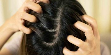 മറ്റ് അവയവങ്ങളെ ബാധിക്കാവുന്ന തരത്തിൽ അണുബാധ  ; പേൻശല്യം ചികിത്സിക്കേണ്ടത് അത്യാവശ്യം