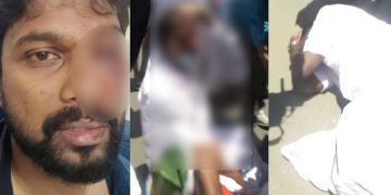 ലാത്തിച്ചാര്‍ജില്‍ യൂത്ത് കോണ്‍ഗ്രസ് നേതാവിന് ഗുരുതര പരിക്ക് ; കാഴ്ചയെ ബാധിച്ചേക്കുമെന്ന് ഡോക്ടര്‍മാര്‍