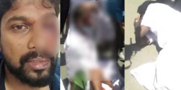 തൊടുപുഴയിലെ പോലീസ് ലാത്തിചാർജ് ; കോൺഗ്രസ് പ്രവർത്തകന്റെ നില ഗുരുതരം