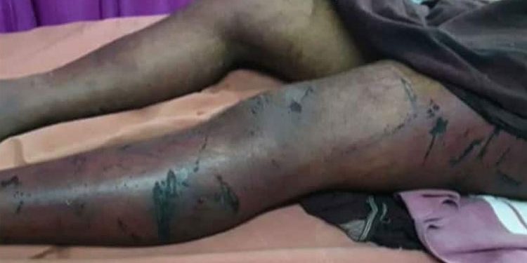 അട്ടപ്പാടിയിൽ 10 അംഗ സംഘത്തിന്റെ അടിയേറ്റ് ചികിത്സയിലായിരുന്ന കണ്ണൂർ സ്വദേശി വിനായകനും മരിച്ചു