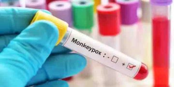മങ്കിപോക്സ് : കേന്ദ്ര മെഡിക്കൽ സംഘം കേരളത്തിൽ, സ്ഥിതി വിലയിരുത്തുന്നു