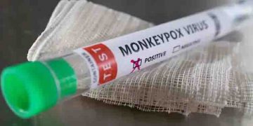 മങ്കിപോക്സ് : സംസ്ഥാനങ്ങൾക്ക് കേന്ദ്രത്തിന്‍റെ ജാഗ്രതാ നിർദ്ദേശം ; ആരോഗ്യ സെക്രട്ടറി കത്തയച്ചു