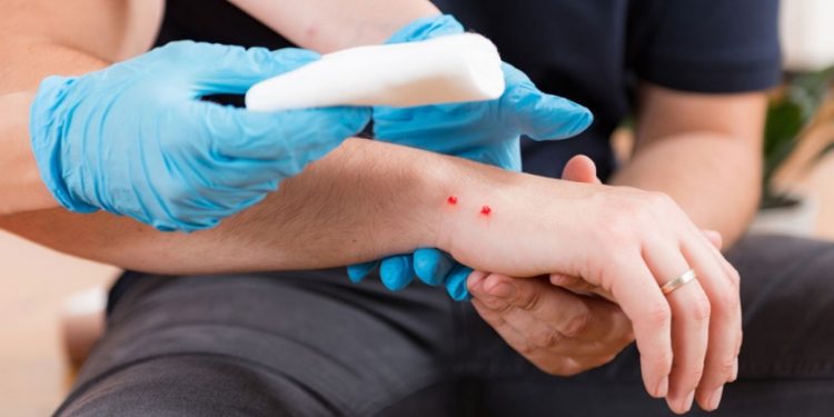 പാമ്പുകടിയേറ്റ് മരിക്കുന്നത് ഒന്നരലക്ഷം പേർ ; ഇക്കാര്യങ്ങൾ ശ്രദ്ധിച്ചാൽ ജീവൻ രക്ഷിക്കാം