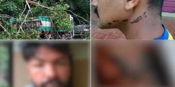 റോഡിൽ വീണ മരം മുറിച്ച് ആഴ്ച കഴിഞ്ഞിട്ടും ചൊറിച്ചിൽ, പൊള്ളൽ, ചർമ്മവും പൊന്തി; ചികിത്സ തുടരുന്നു, ഭയപ്പാടും