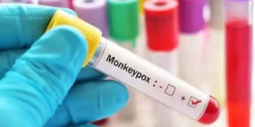തൃശ്ശൂരിലെ യുവാവിന്‍റെ മരണകാരണം മങ്കിപോക്സ്, സ്ഥിരീകരിച്ചു, രാജ്യത്തെ ആദ്യ മങ്കിപോക്സ് മരണം
