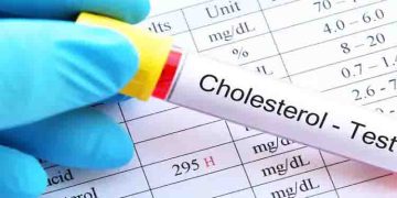 ഉയർന്ന കൊളസ്ട്രോൾ നിയന്ത്രിക്കുന്നതിന് ഇതാ ചില ടിപ്സുകൾ