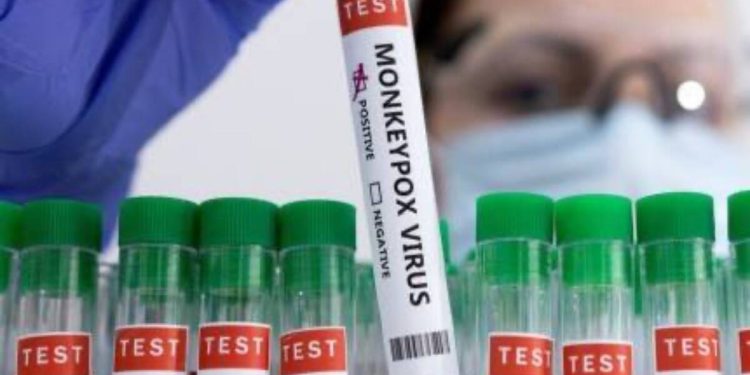 സമൂഹം കുറ്റപ്പെടുത്തുമെന്ന് ഭയം; മങ്കിപോക്സ് ടെസ്റ്റ് നടത്താൻ സ്വവർഗാനുരാഗികൾ മടിക്കുന്നു