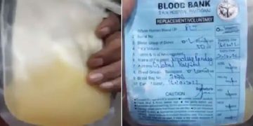 പ്ലേറ്റ് ലെറ്റിന് പകരം ജ്യൂസ് കുത്തിവെച്ച് രോഗി മരിച്ച ആശുപത്രി പൊളിക്കും; സർക്കാർ ഉത്തരവിറക്കി