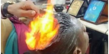 ഫയർ ഹെയർകട്ട് പാളി; മുടിവെട്ടാനെത്തിയ 18കാരന് ​ഗുരുതരമായി പൊള്ളലേറ്റു