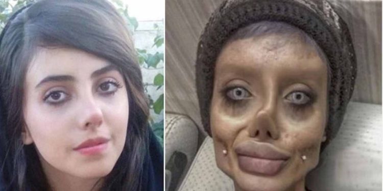 ആഞ്ജലീന ജോളിയാകാൻ ‘വ്യാജ’ ശസ്ത്രക്രിയ; മുഖം വെളിപ്പെടുത്തി ജയിൽ മോചിതയായ യുവതി