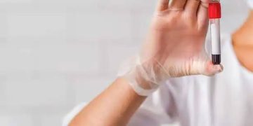 ലക്ഷണങ്ങള്‍ കാണാത്തതിനാല്‍ അറിയാതെ പോകുന്ന നാല് ലൈംഗികരോഗങ്ങള്‍…