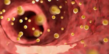 ഉയർന്ന കൊളസ്‌ട്രോൾ ഉണ്ടെങ്കിൽ കാലിൽ കാണുന്ന ഒരു ലക്ഷണമിതാണ്