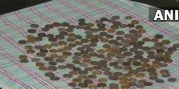 58കാരന്റെ വയറ്റില്‍ നിന്ന് ഡോക്ടര്‍മാര്‍ നീക്കം ചെയ്തത് 187 നാണയങ്ങള്‍