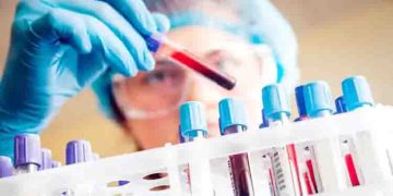 ഇന്ത്യയില്‍ ഇന്ന് ഏറ്റവുമധികം റിപ്പോര്‍ട്ട് ചെയ്യപ്പെടുന്ന 10 രോഗങ്ങള്‍ ഏതെല്ലാമാണെന്ന് അറിയാമോ?