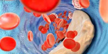 ഉയർന്ന കൊളസ്ട്രോളിന് കാരണമാകുന്ന അഞ്ച് ഭക്ഷണങ്ങൾ