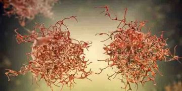 കാൻസർ സാധ്യത കുറയ്ക്കുന്നതിന് ജീവിതശെെലിയിൽ ശ്രദ്ധിക്കേണ്ട 5 കാര്യങ്ങൾ