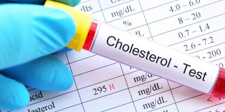 കൊളസ്ട്രോള്‍ കുറയ്ക്കാന്‍ ഈ അഞ്ച് ജീവിതശൈലീ മാറ്റങ്ങള്‍