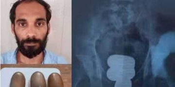 ശരീരത്തിനുള്ളിൽ ഒളിപ്പിച്ച് കടത്താൻ ശ്രമിച്ച ഒരു കിലോ സ്വർണവുമായി കരിപ്പൂർ വിമാനത്താവളത്തിൽ ഒരാൾ പിടിയില്‍