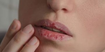 മുഴുവൻ സമയവും ചുണ്ട് വരണ്ട് പൊട്ടുകയാണോ? എങ്കില്‍ ചെയ്യാവുന്നത്…