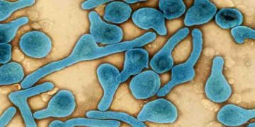 മാർബർഗ് രോഗം സ്ഥിരീകരിച്ച് ലോകാരോഗ്യ സംഘടന ; ലക്ഷണങ്ങൾ എന്തൊക്കെ? അറിയേണ്ടതെല്ലാം