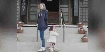 ഈ ഇരട്ട സഹോദരിമാർ തമ്മിലുള്ള ഉയരവ്യത്യാസം 75 സെൻറീമീറ്റർ