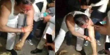 ബിജെപി മന്ത്രിക്ക് നേരെ ചൊറിപ്പൊടിയേറ്, പൊതുജന മധ്യത്തിൽ കുർത്തയൂരി കഴുകി മന്ത്രി