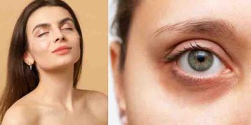 കണ്ണിന് ചുറ്റുമുള്ള ‘ഡാർക്ക് സർക്കിൾസ്’ മാറ്റാൻ ഈ ചേരുവകള്‍ ഉപയോ​ഗിക്കൂ…