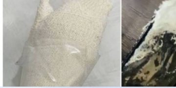 കൈയിലിരുന്ന മൊബൈല്‍ ഫോൺ പൊട്ടിത്തെറിച്ച് 13 വയസുകാരിക്ക് പൊള്ളലേറ്റു